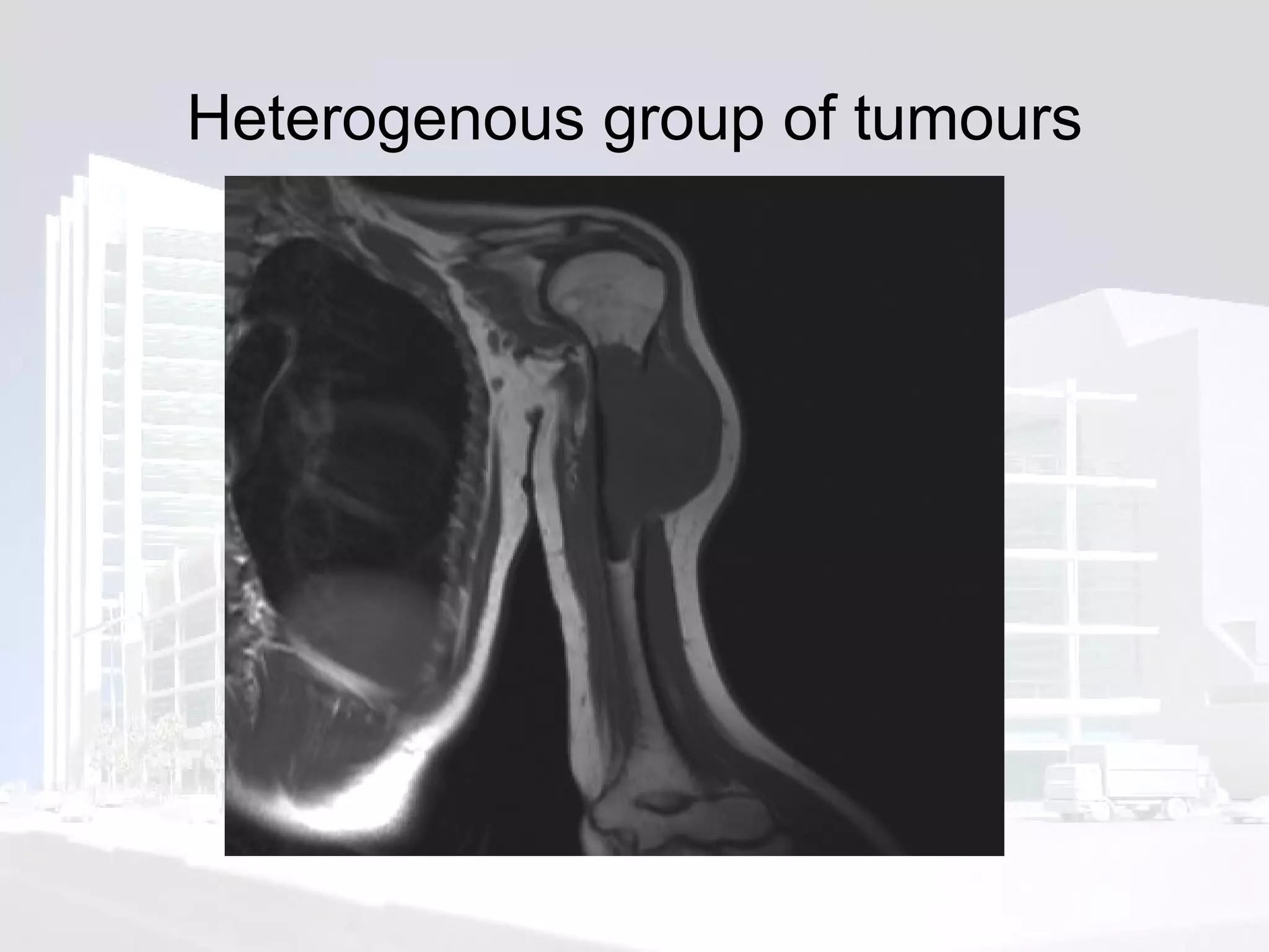 Heterogenous group of tumours 