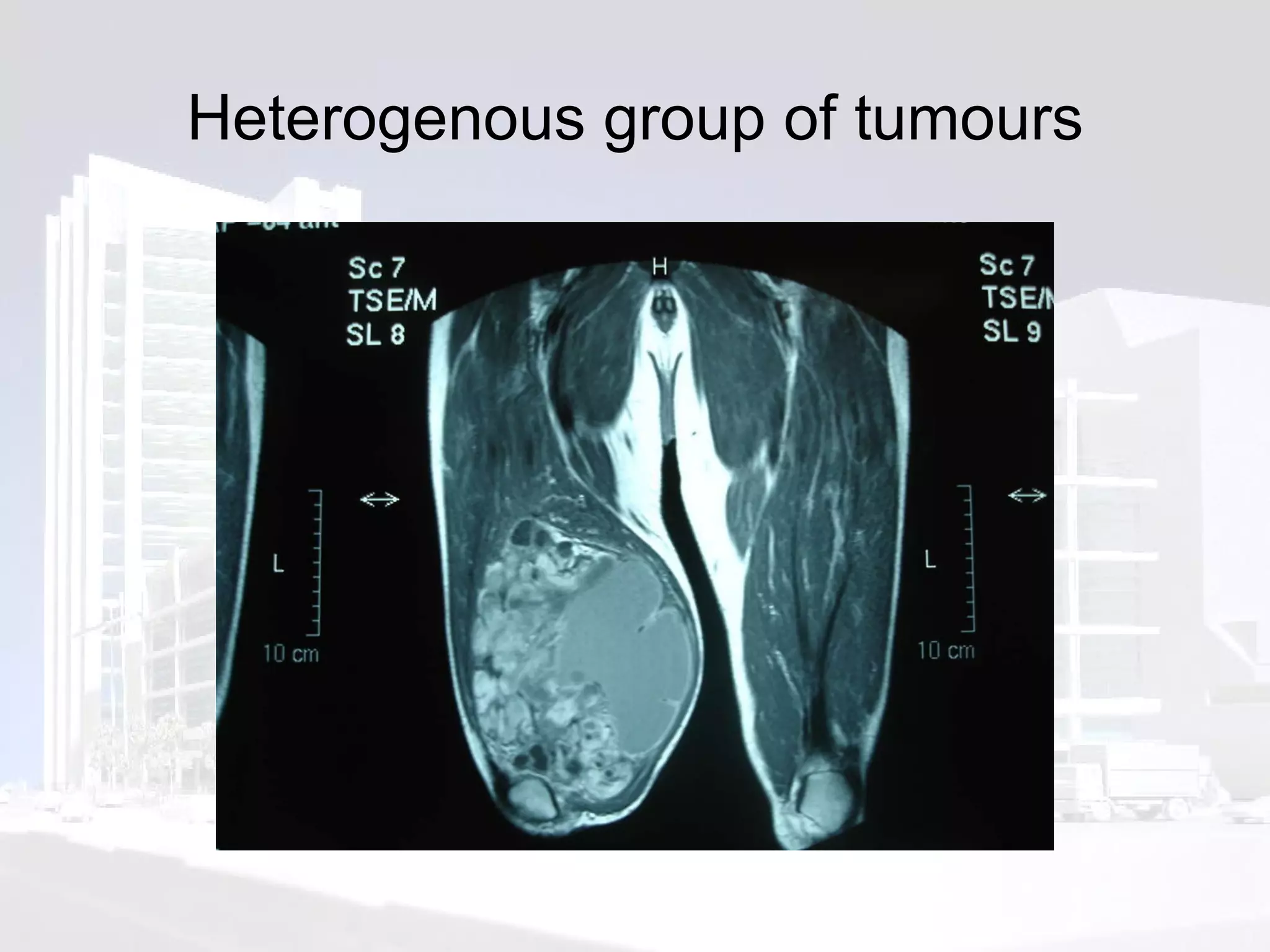 Heterogenous group of tumours 