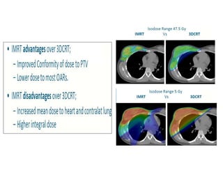 Radiotherapy Breast Cancer | PDF