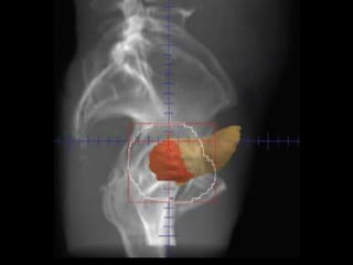 Radiotherapy for bladder cancer part ii | PPTX