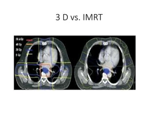 3 D vs. IMRT
 