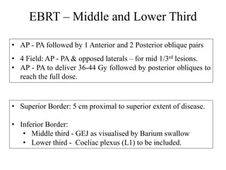 EBRT – Middle and Lower Third
• Superior Border: 5 cm proximal to superior extent of disease.
• Inferior Border:
• Middle third - GEJ as visualised by Barium swallow
• Lower third - Coeliac plexus (L1) to be included.
• AP - PA followed by 1 Anterior and 2 Posterior oblique pairs
• 4 Field: AP - PA & opposed laterals – for mid 1/3rd lesions.
• AP - PA to deliver 36-44 Gy followed by posterior obliques to
reach the full dose.
 