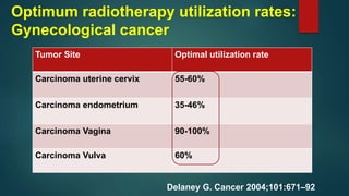 Optimum radiotherapy utilization rates:
Gynecological cancer
Delaney G. Cancer 2004;101:671–92
Tumor Site Optimal utilizat...