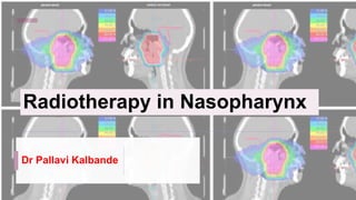 Radiotherapy in Nasopharynx
Dr Pallavi Kalbande
 