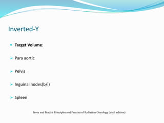 Inverted-Y
 Target Volume:
 Para aortic
 Pelvis
 Inguinal nodes(b/l)
 Spleen
Perez and Brady’s Principles and Practice of Radiation Oncology (sixth edition)
 
