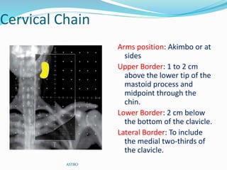 Cervical Chain
Arms position: Akimbo or at
sides
Upper Border: 1 to 2 cm
above the lower tip of the
mastoid process and
midpoint through the
chin.
Lower Border: 2 cm below
the bottom of the clavicle.
Lateral Border: To include
the medial two-thirds of
the clavicle.
ASTRO
 