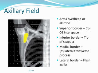 Axillary Field
 Arms overhead or
akimbo
 Superior border – C5-
C6 interspace
 Inferior border – Tip
of scapula
 Medial border –
Ipsilateral transverse
process
 Lateral border – Flash
axilla
ASTRO
 