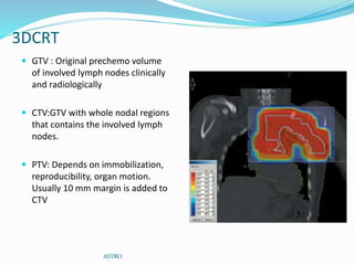 3DCRT
 GTV : Original prechemo volume
of involved lymph nodes clinically
and radiologically
 CTV:GTV with whole nodal regions
that contains the involved lymph
nodes.
 PTV: Depends on immobilization,
reproducibility, organ motion.
Usually 10 mm margin is added to
CTV
ASTRO
 