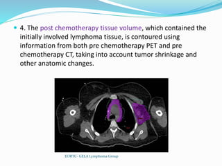  4. The post chemotherapy tissue volume, which contained the
initially involved lymphoma tissue, is contoured using
information from both pre chemotherapy PET and pre
chemotherapy CT, taking into account tumor shrinkage and
other anatomic changes.
EORTC- GELA Lymphoma Group
 