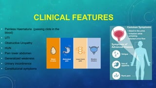 CLINICAL FEATURES
• Painless Haematuria (passing clots in the
blood)
• UTI
• Obstructive Uropathy
• HUN
• Pain lower abdomen
• Generalized weakness
• Urinary incontinence
• Constitutional symptoms
 