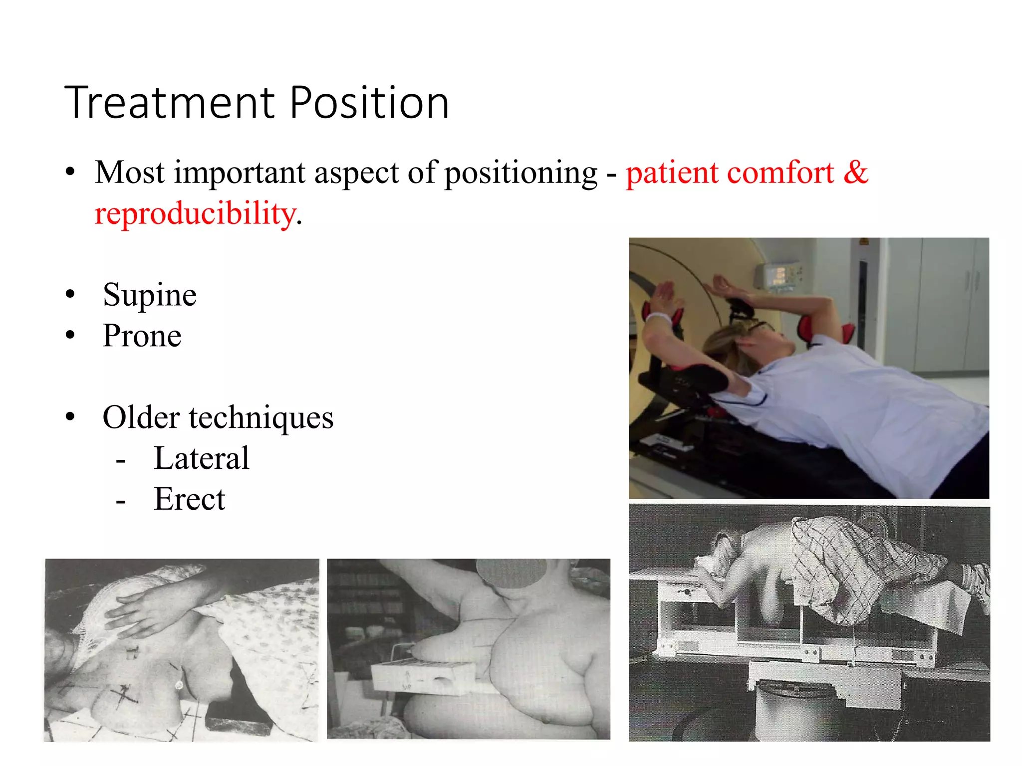 Radiotherapy techniques for Breast Cancer | PDF
