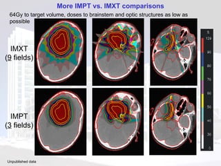 More IMPT vs. IMXT comparisons 64Gy to target volume, doses to brainstem and optic structures as low as possible IMXT ( 9  fields) IMPT ( 3  fields) Unpublished data   z = 49 z = 49 z = 57 z = 57 z = 64 z = 64 