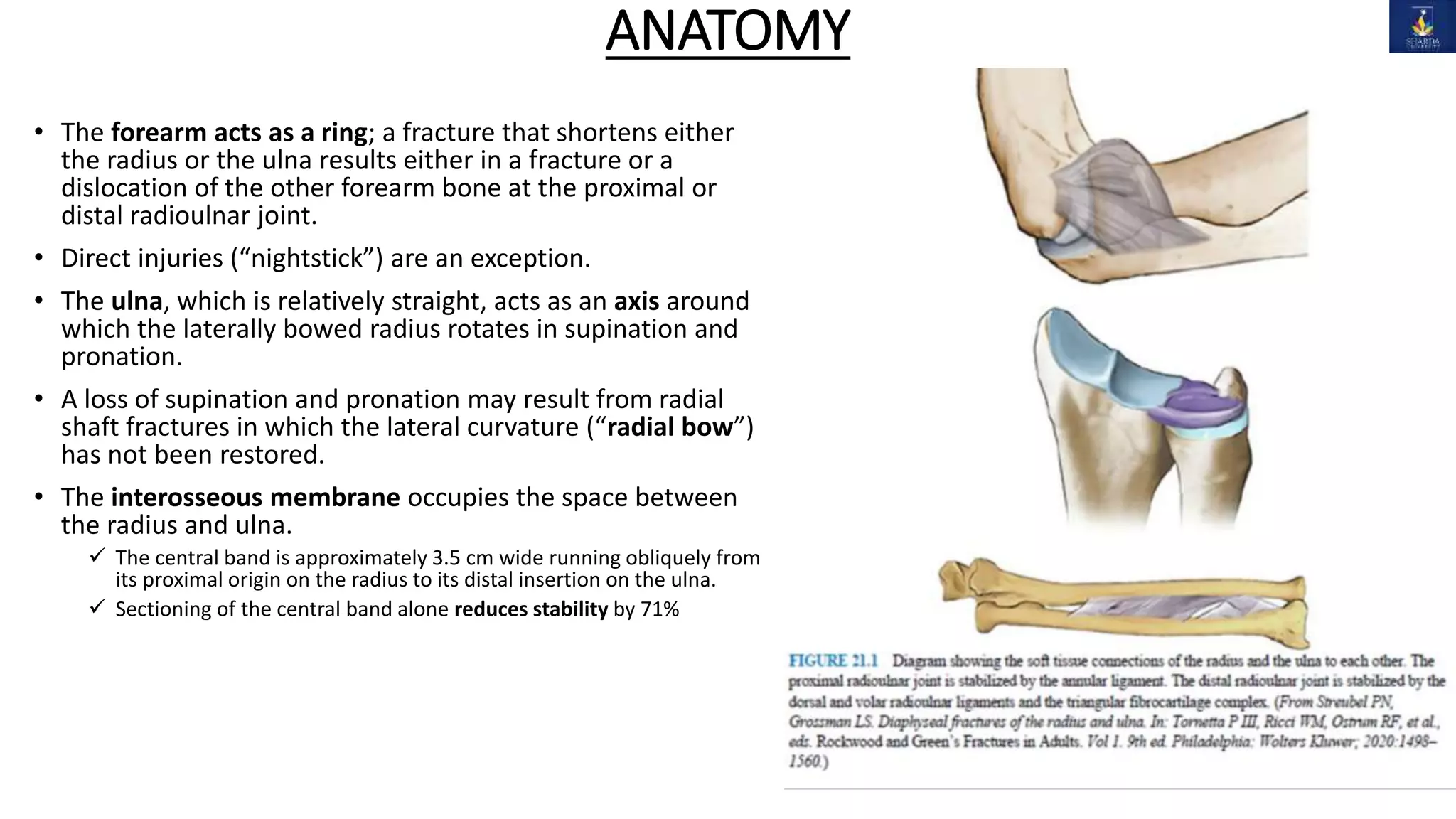 Radius and Ulna Shaft Fracture | PPTX