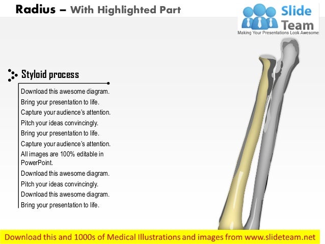 Radius posterior view medical images for power point