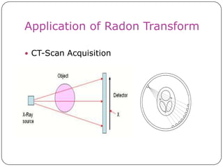 Application of Radon Transform

 CT-Scan Acquisition
 