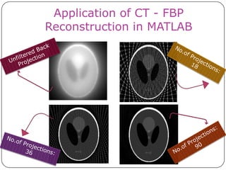Application of CT - FBP
Reconstruction in MATLAB
 