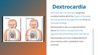 Transposed Organs RADIOLOGICAL PATHOLOGY RESPIRATORY SYSTEM.pptx