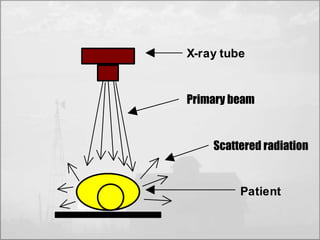 X-ray tube 
Primary beam 
Scattered radiation 
Patient 
 