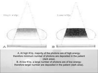 A. At high KVp, majority of the photons are of high energy; 
therefore minimum number of photons are deposited in the patient 
(dark area). 
B. At low KVp, a large number of photons are of low energy; 
therefore larger number are deposited in the patient (dark area). 
 