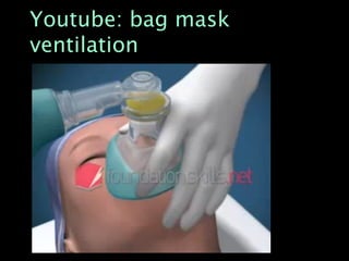 Youtube: bag mask
ventilation
 