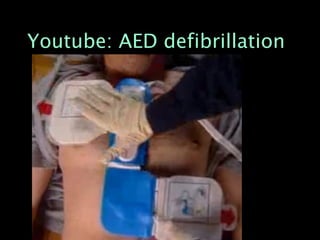 Youtube: AED defibrillation
 