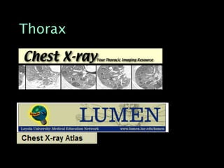 Thorax
 