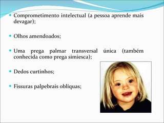 Comprometimento intelectual (a pessoa aprende mais devagar);  Olhos amendoados; Uma prega palmar transversal única (também conhecida como prega simiesca); Dedos curtinhos; Fissuras palpebrais oblíquas; 