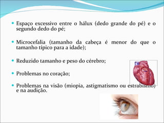 Espaço excessivo entre o hálux (dedo grande do pé) e o segundo dedo do pé; Microcefalia (tamanho da cabeça é menor do que o tamanho típico para a idade); Reduzido tamanho e peso do cérebro;  Problemas no coração; Problemas na visão (miopia, astigmatismo ou estrabismo) e na audição. 