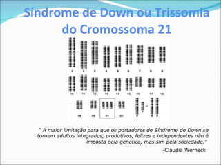 Síndrome de Down ou Trissomia do Cromossoma 21 “  A maior limitação para que os portadores de Síndrome de Down se tornem adultos integrados, produtivos, felizes e independentes não é imposta pela genética, mas sim pela sociedade.”   - Claudia Werneck   