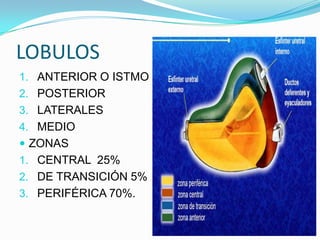 LOBULOS
1. ANTERIOR O ISTMO
2. POSTERIOR
3. LATERALES
4. MEDIO
 ZONAS
1. CENTRAL 25%
2. DE TRANSICIÓN 5%
3. PERIFÉRICA 70%.
 