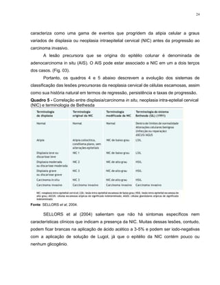 24
caracteriza como uma gama de eventos que progridem da atipia celular a graus
variados de displasia ou neoplasia intraepitelial cervical (NIC) antes da progressão ao
carcinoma invasivo.
A lesão precursora que se origina do epitélio colunar é denominada de
adenocarcinoma in situ (AIS). O AIS pode estar associado a NIC em um a dois terços
dos casos. (Fig. 03).
Portanto, os quadros 4 e 5 abaixo descrevem a evolução dos sistemas de
classificação das lesões precursoras da neoplasia cervical de células escamosas, assim
como sua história natural em termos de regressão, persistência e taxas de progressão.
Quadro 5 - Correlação entre displasia/carcinoma in situ, neoplasia intra-eptelial cervical
(NIC) e terminologia de Bethesda
Fonte: SELLORS et al, 2004.
SELLORS et al (2004) salientam que não há sintomas específicos nem
características clínicos que indicam a presença da NIC. Muitas dessas lesões, contudo,
podem ficar brancas na aplicação de ácido acético a 3-5% e podem ser iodo-negativas
com a aplicação de solução de Lugol, já que o epitélio da NIC contém pouco ou
nenhum glicogênio.
 