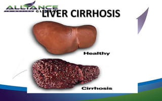 LIVER CIRRHOSIS
 