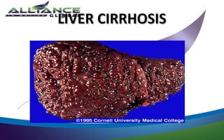 LIVER CIRRHOSIS
 