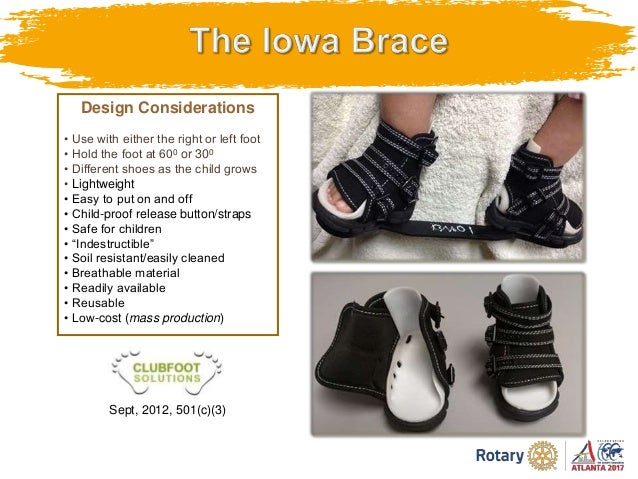 Clubfoot Initiatives How A Rotarian Action Group Can Help