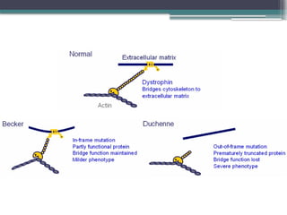 Comprehensive Overview of Muscular Dystrophy Types, Causes, and ...