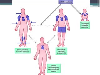 Comprehensive Overview of Muscular Dystrophy Types, Causes, and ...