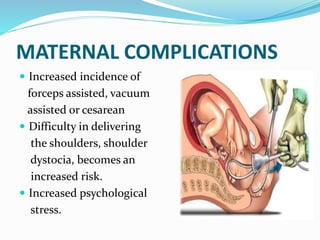 MATERNAL COMPLICATIONS
 Increased incidence of
forceps assisted, vacuum
assisted or cesarean
 Difficulty in delivering
the shoulders, shoulder
dystocia, becomes an
increased risk.
 Increased psychological
stress.
 