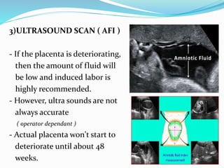 3)ULTRASOUND SCAN ( AFI )
- If the placenta is deteriorating,
then the amount of fluid will
be low and induced labor is
highly recommended.
- However, ultra sounds are not
always accurate
( operator dependant )
- Actual placenta won't start to
deteriorate until about 48
weeks.
 