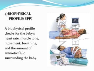 4)BIOPHYSICAL
PROFILE(BPP)
A biophysical profile
checks for the baby's
heart rate, muscle tone,
movement, breathing,
and the amount of
amniotic fluid
surrounding the baby.
 