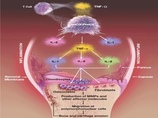 Gout Racgp RA & gout.ppt RA & gout.ppt RA & gout.ppt