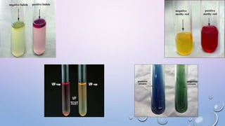 MICROBIOLOGICAL TESTS (CONVENTIONAL METHODS )