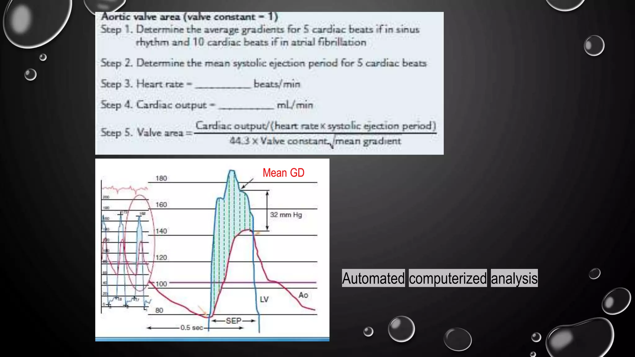 Mean GD
Automated computerized analysis
 