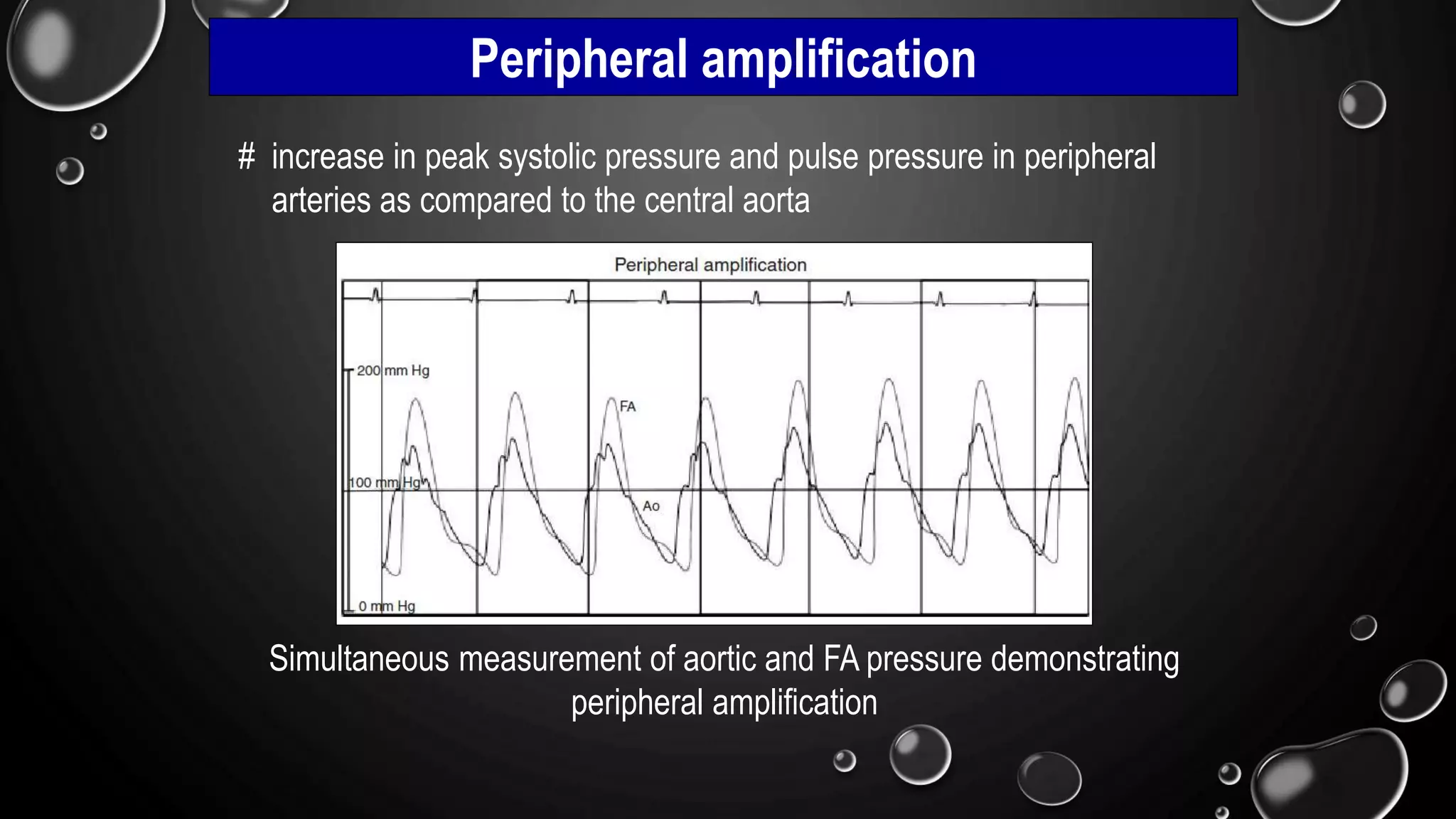 Simultaneous measurement of aortic and FA pressure demonstrating
peripheral amplification
Peripheral amplification
# increase in peak systolic pressure and pulse pressure in peripheral
arteries as compared to the central aorta
 