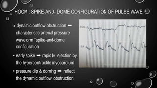 hemodynamic in cath lab: aortic stenosis and hocm | PPTX
