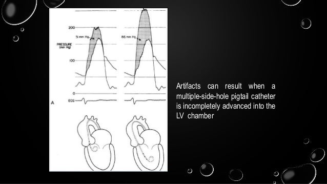 hemodynamic in cath lab: aortic stenosis and hocm