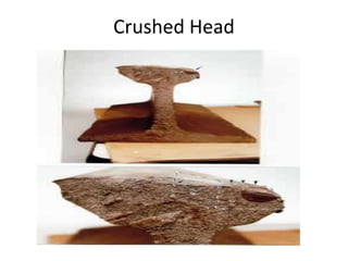 Crushed Head
 