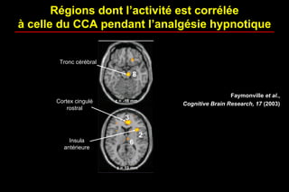 Régions dont l’activité est corrélée
à celle du CCA pendant l’analgésie hypnotique
Tronc cérébral
Cortex cingulé
rostral
Insula
antérieure
Faymonville et al.,
Cognitive Brain Research, 17 (2003)
 