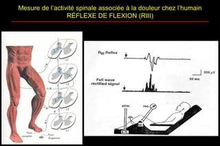 Mesure de l’activité spinale associée à la douleur chez l’humain
RÉFLEXE DE FLEXION (RIII)
 