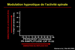 Modulation hypnotique de l’activité spinale
Kiernan et al., Pain 60 (1995)
DIMINUTIONDELADOULEUR(ÉVA)
DIMINUTION DU RÉFLEXE R-III
 