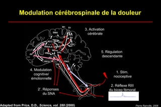 1. Stim.
nociceptive
2. Réflexe RIII
du bicep fémoral
3. Activation
cérébrale
Série1
5. Régulation
descendante
4. Modulation
cognitive/
émotionnelle
Adapted from Price, D.D., Science, vol. 288 (2000)
Modulation cérébrospinale de la douleur
2’. Réponses
du SNA
Pierre Rainville, 2006
 